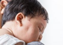 Cara Mencegah dan Mengatasi Biang Keringat Pada Bayi