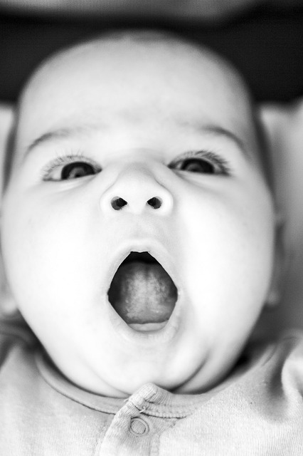 Lidah Putih Pada Bayi